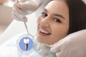 Dental Implants Wimbledon